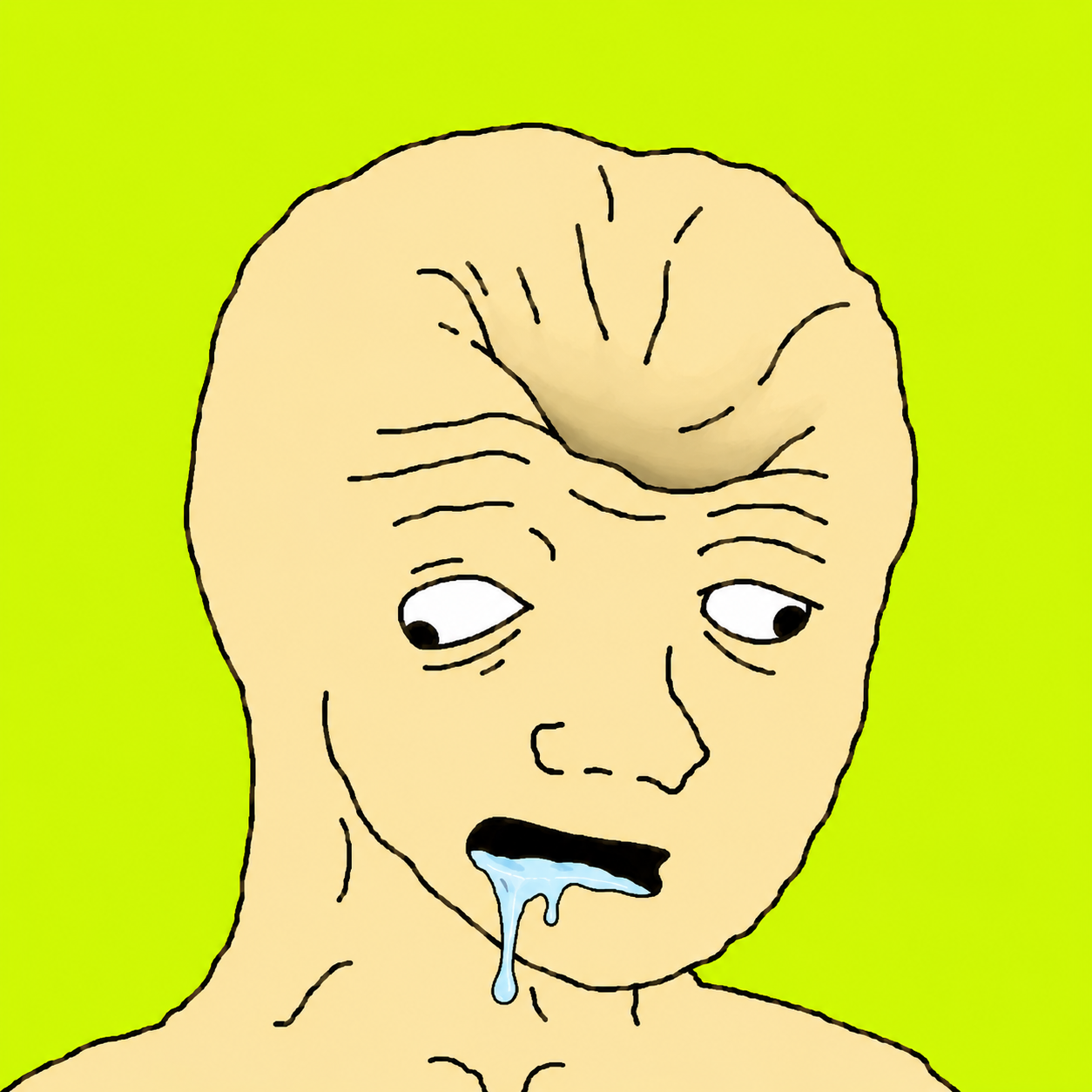 $tism mascot: a smooth-brained drooling wojak on a bright green background